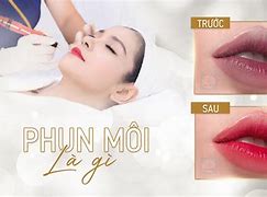 Thẩm Mỹ Viện Hoài Anh Ở Đầu Gối